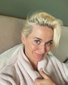 Katy Perry eye fillers