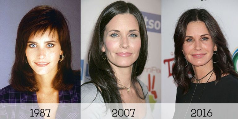 Courteney Cox before and after fillers