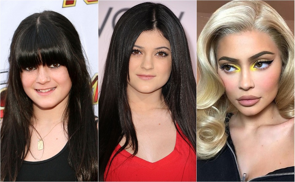 Kylie Jenner before and after