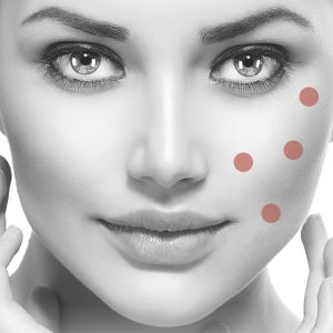 Ejal 40: a good alternative to Profhilo