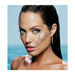 Cheeks and cheekbone correction techniques