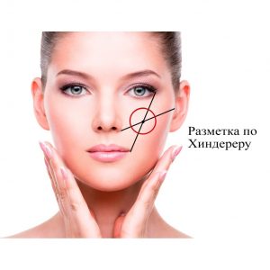 Cheeks and cheekbone correction techniques