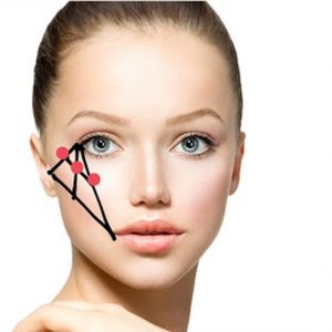 Cheeks and cheekbone correction techniques